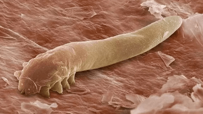 Parassiti nel corpo umano