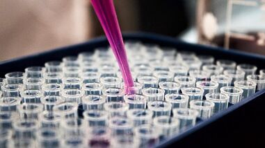 Come fare i test per il rilevamento di parassiti nel corpo